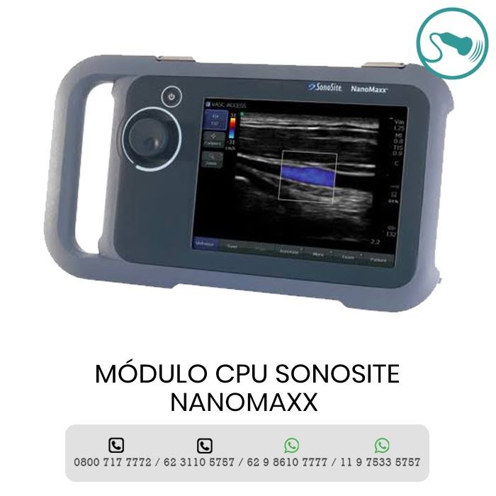 MANUTENÇÃO SONOSITE NANOMAX