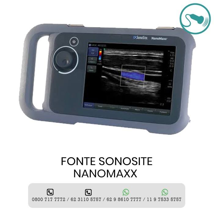 MANUTENÇÃO SONOSITE EDGE