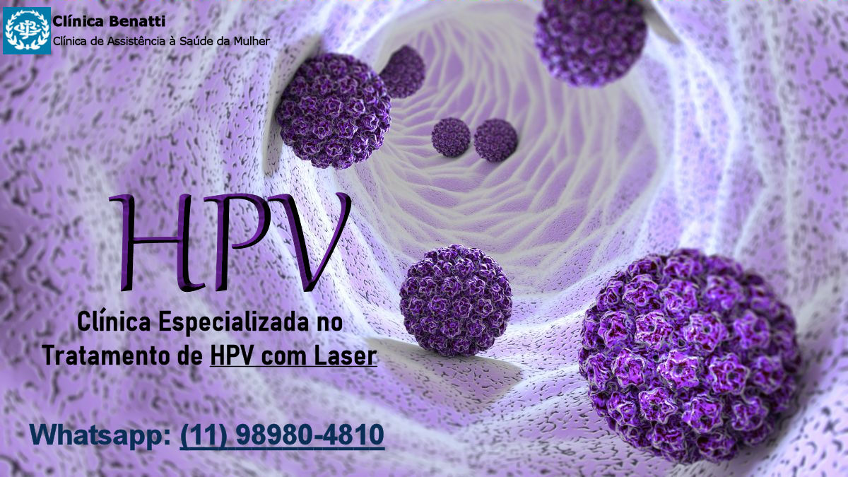 tratamento-laser-hpv-clinica-benatti